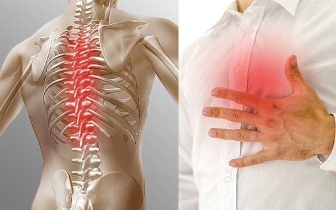 Torazeko osteokondrosia mina eta bularrean estutasun sentsazioa adierazten du